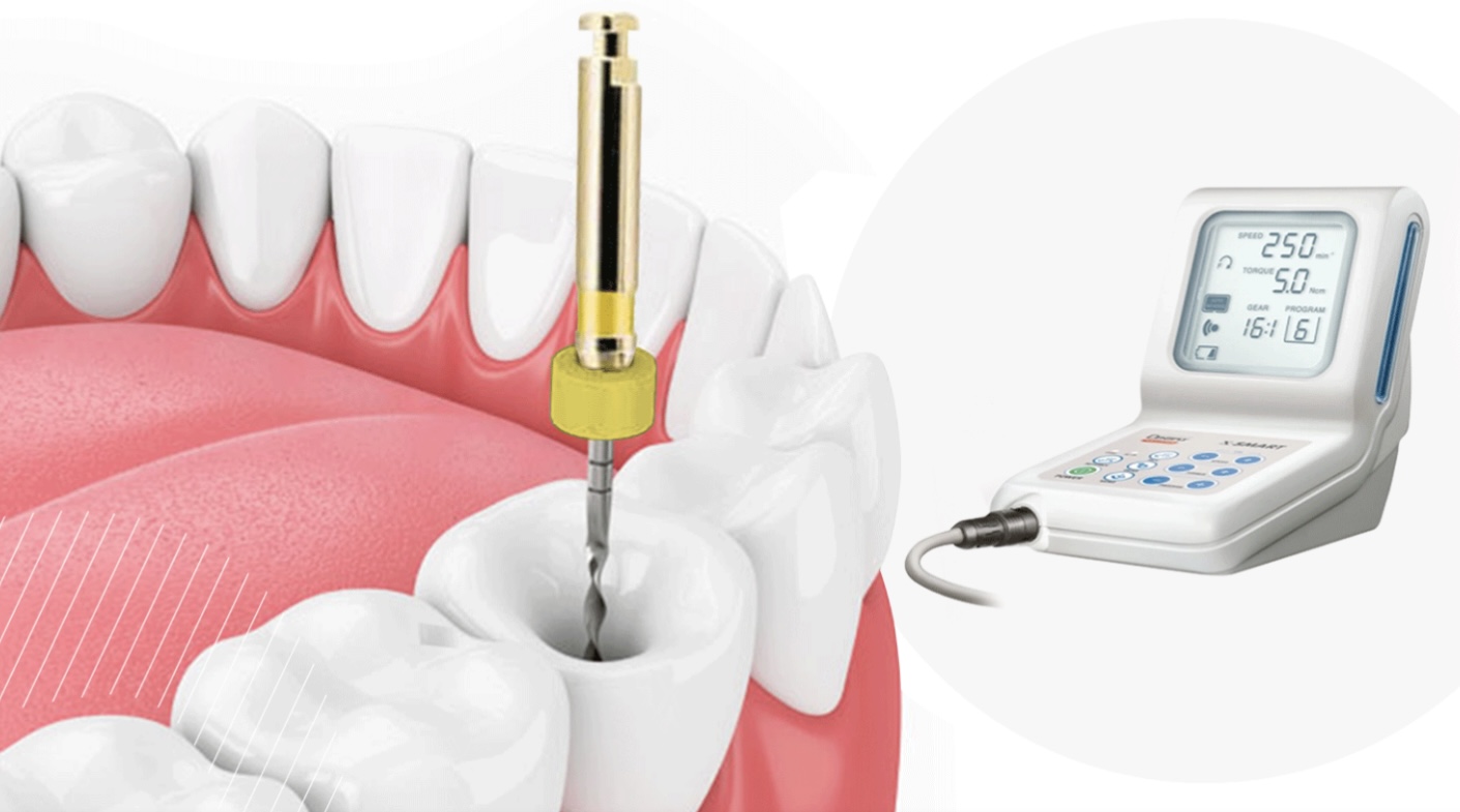 Paso 3: Instrumentación 