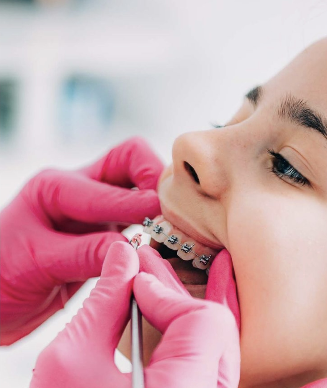 Paso 3: Inicio del tratamiento