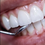 Paso 3: Revisión y control en el tiempo