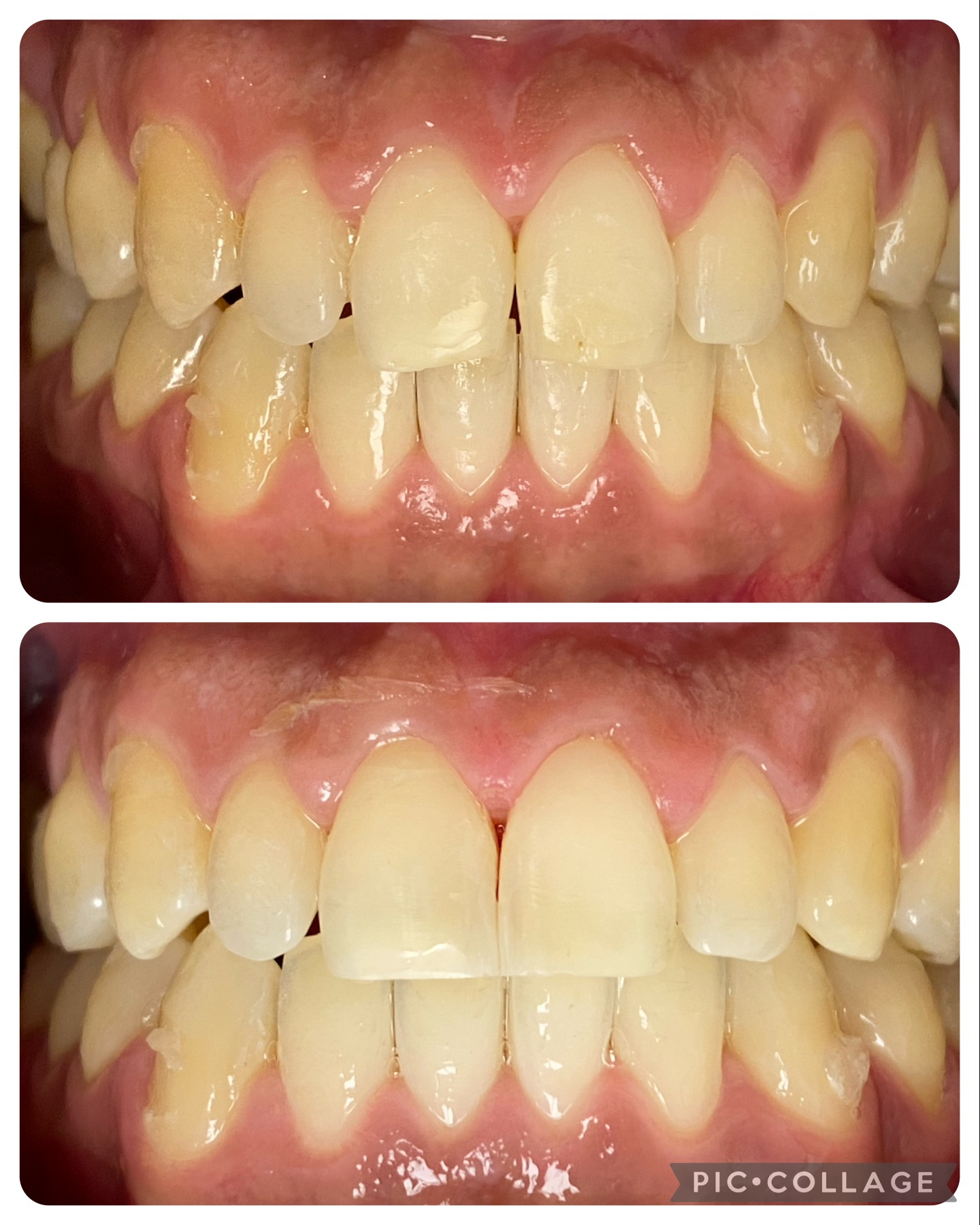 Reconstrucciones esteticas