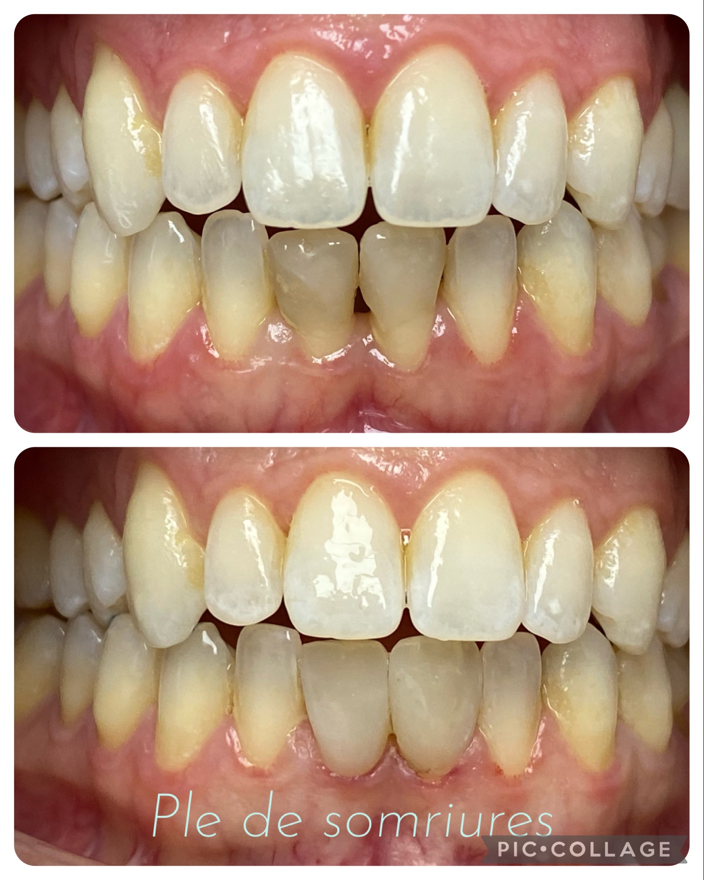 reconstrucciones esteticas