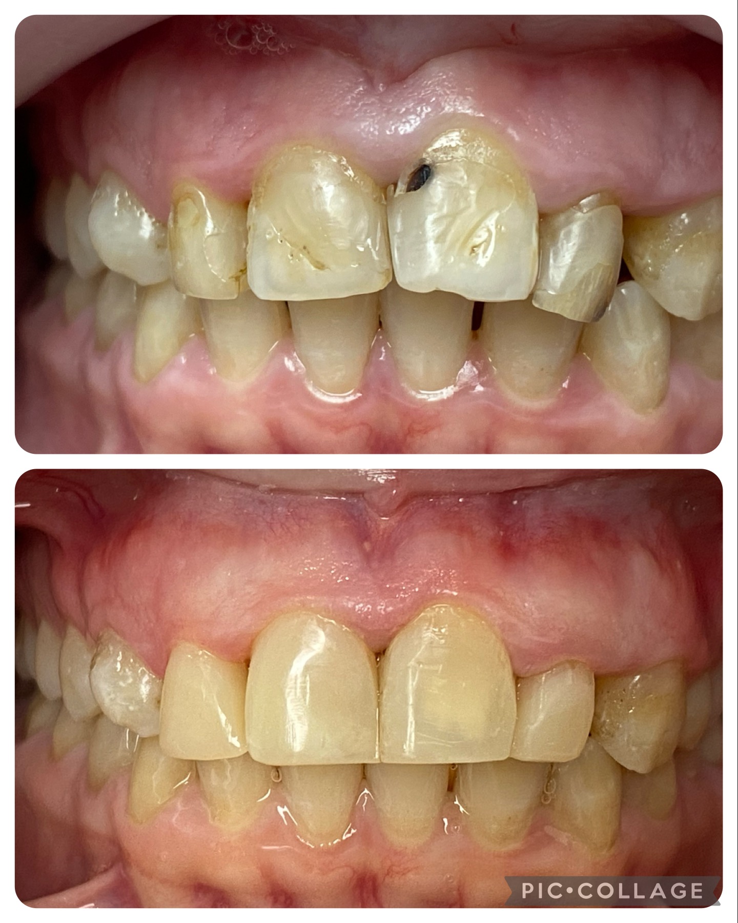 reconstrucciones esteticas(1)