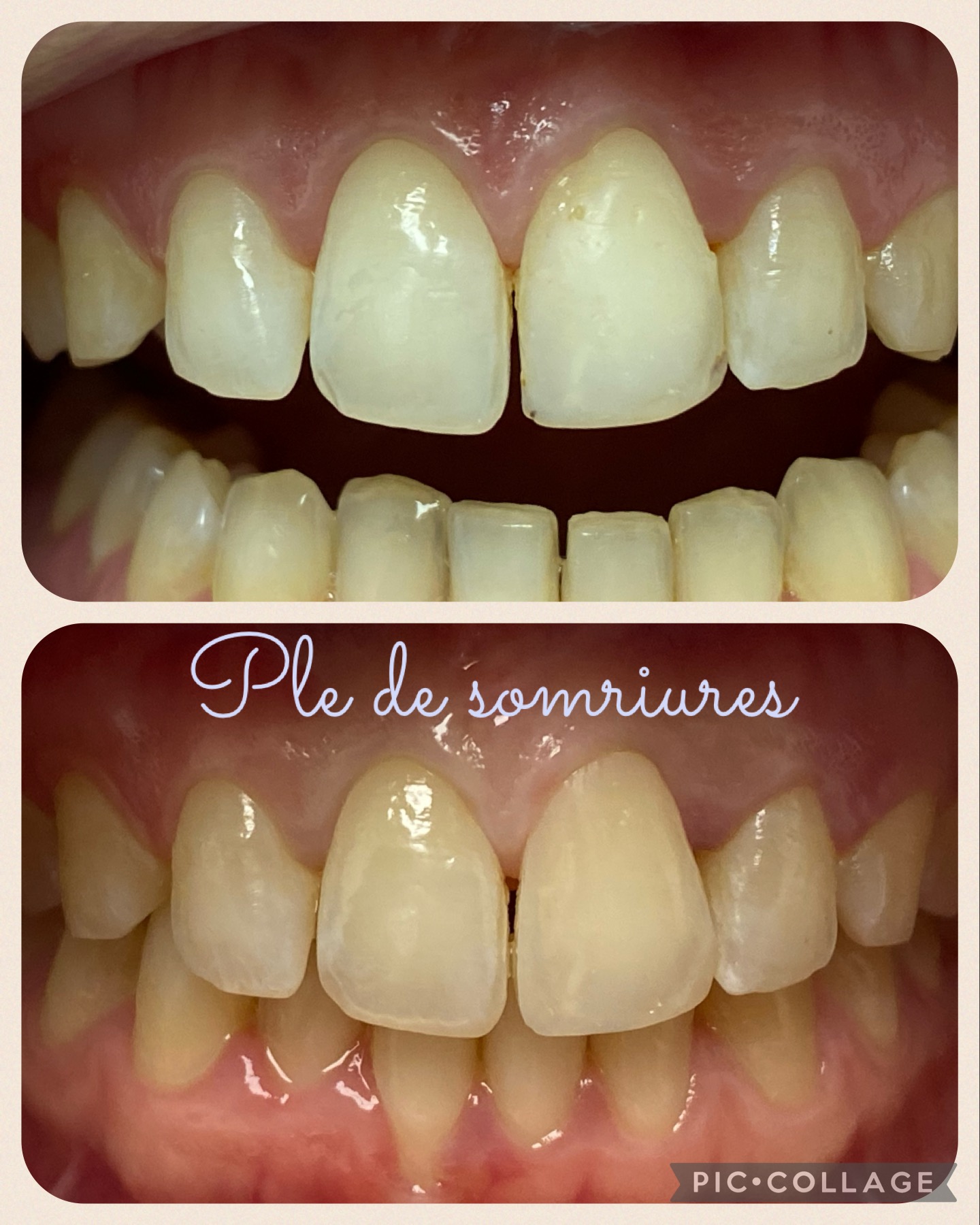 recs esteticas actualizacion